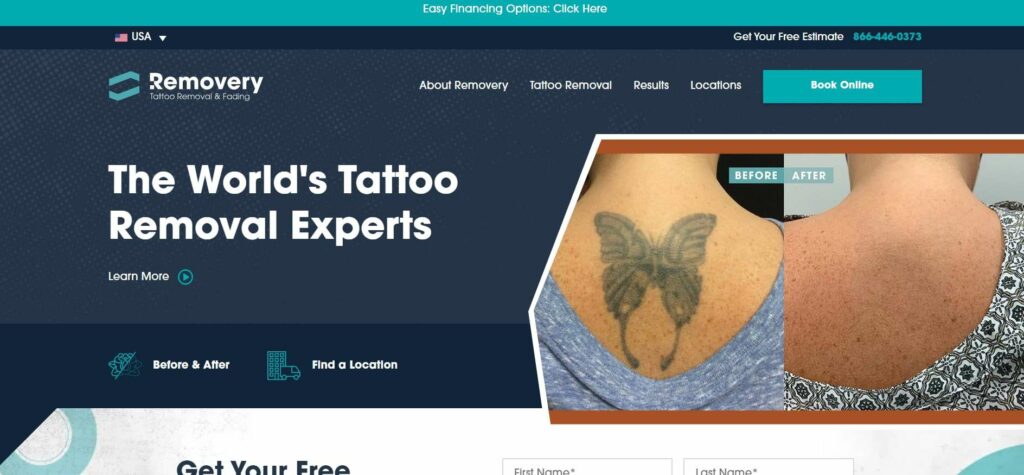 Removery Tattoo Removal and Fading Homepage
