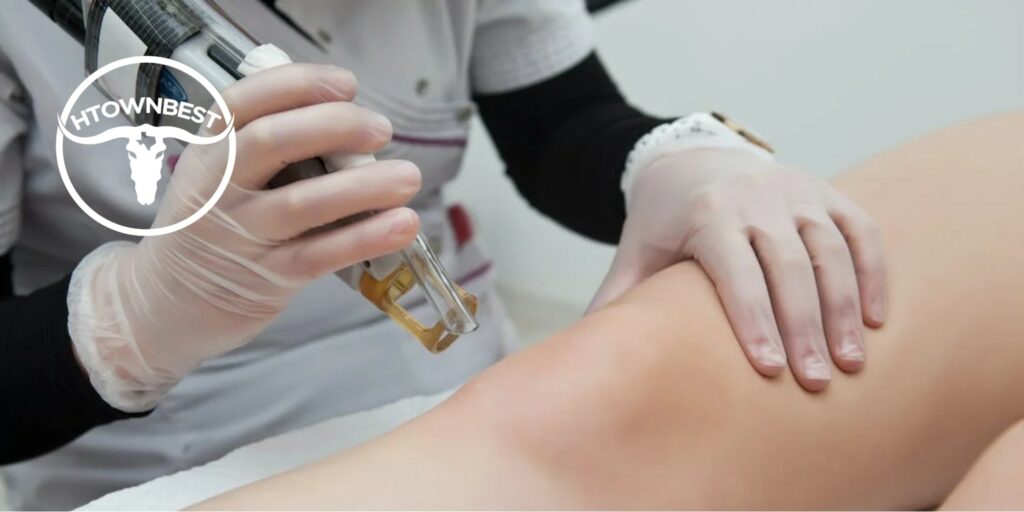Top 5 Places to Get Your Tattoo Removed in Houston