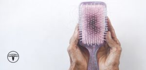 Top 5 Houston Hair Transplant Specialists
