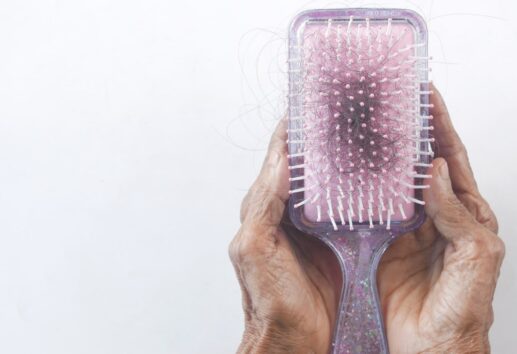 Top 5 Houston Hair Transplant Specialists