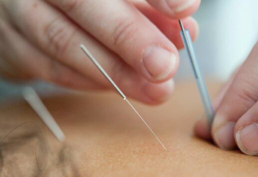 5 Best Acupuncture Clinics in Houston